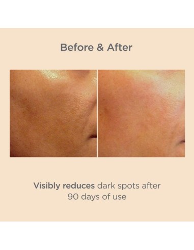 ISDINCEUTICS MELACLEAR ADVANCED  1 ENVASE 30 ML