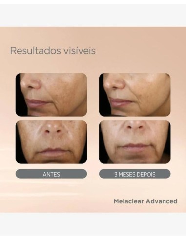 ISDINCEUTICS MELACLEAR ADVANCED  1 ENVASE 30 ML