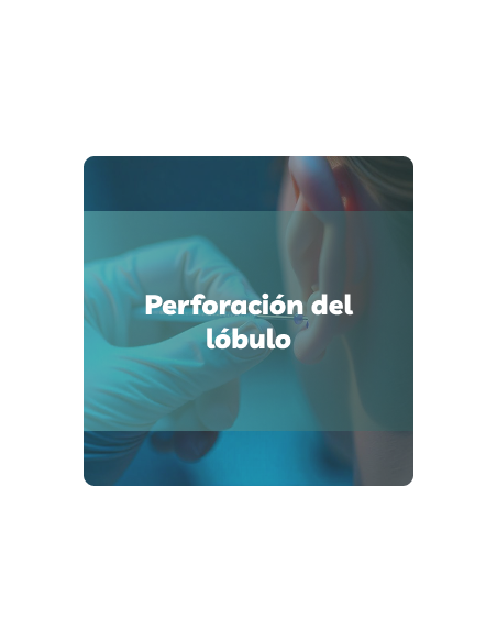 Perforación del lóbulo