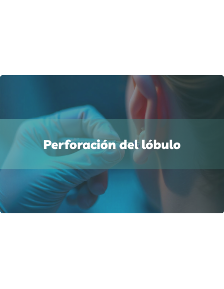 Perforación del lóbulo