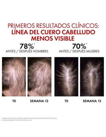 Dercos Serum Capilar Aminexil Clinical Regen 90ml