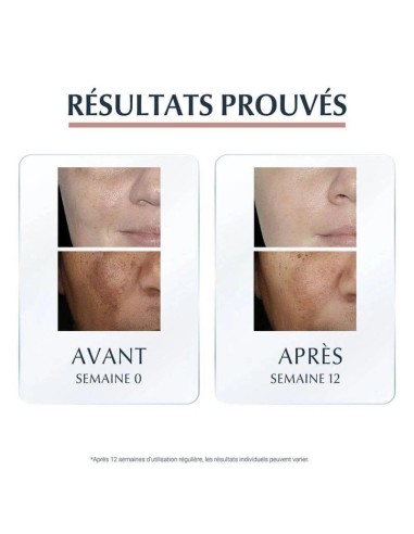 Eucerin - Antipigment Serum Duo 30 ml