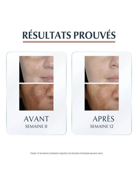 Eucerin - Antipigment Serum Duo 30 ml