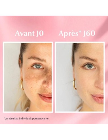 Eucerin - Antipigment Serum Duo 30 ml