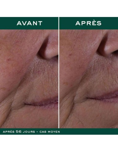 NUXURIANCE ULTRA CREMA ANTIEDAD GLOBAL  1 ENVASE 50 ML