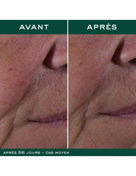 NUXURIANCE ULTRA CREMA ANTIEDAD GLOBAL  1 ENVASE 50 ML