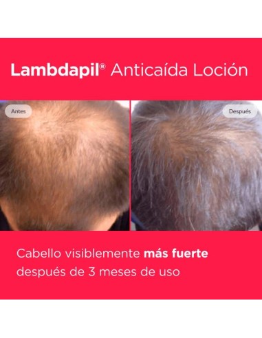 ISDIN LAMBDAPIL MELATONIN CONCRENTRATE LOCION 100 ML