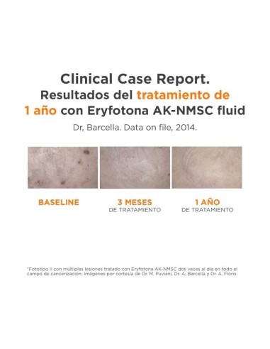 ERYFOTONA AK-NMSC FLUIDO  1 ENVASE 50 ML