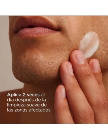 ISDIN NUTRADEICA SEBORREICA SKIN GELCREMA FACIAL  